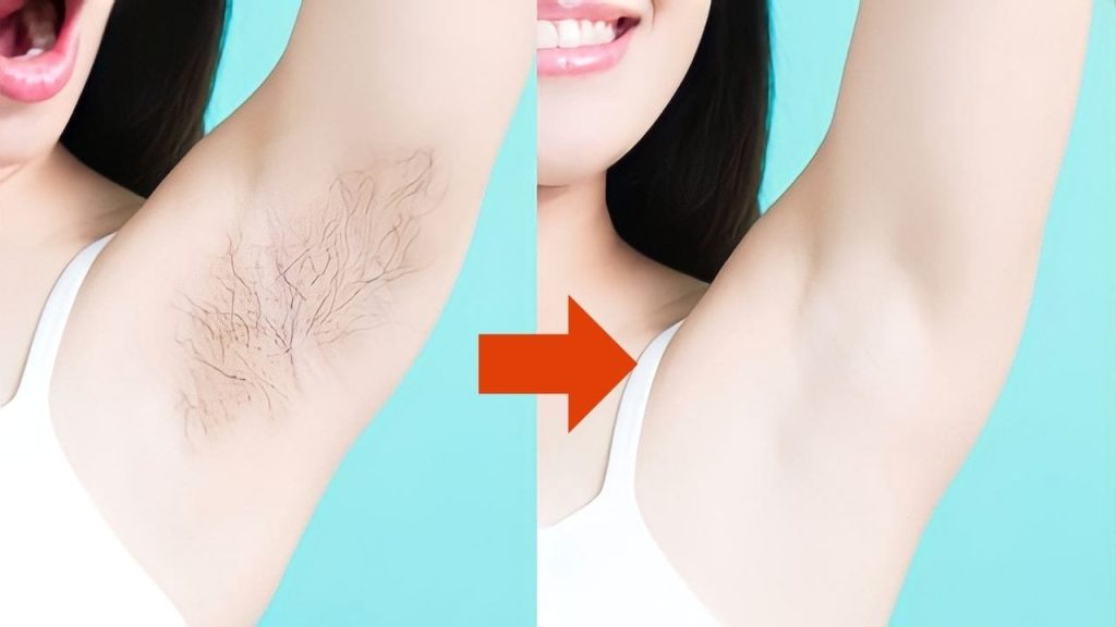 No más navajas, el vello facial y corporal se deshace de él con este querido ingrediente.